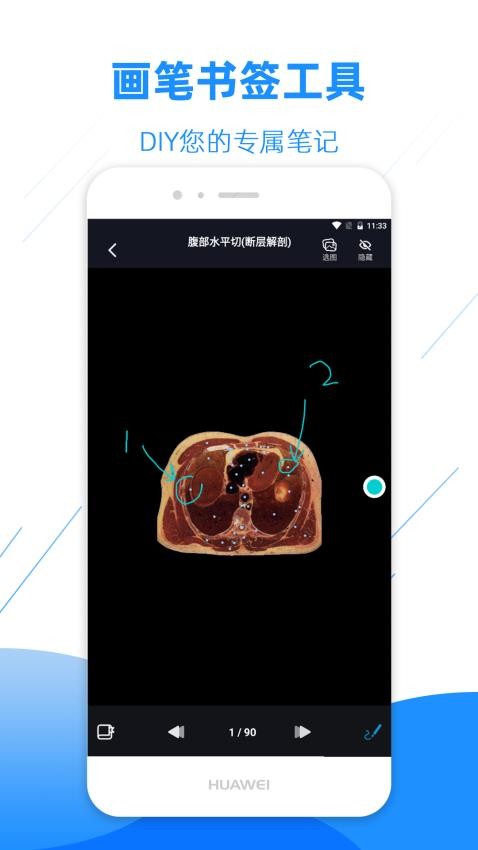 影像解剖图谱免费版v3.9.9截图3