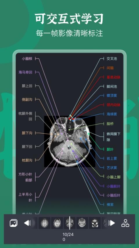 万康人体解剖最新版(4)