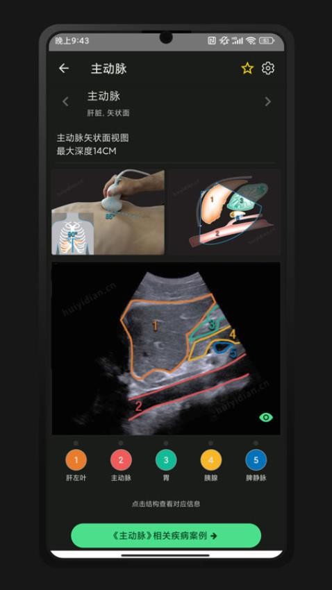 超声智学官方版v1.0.1截图5