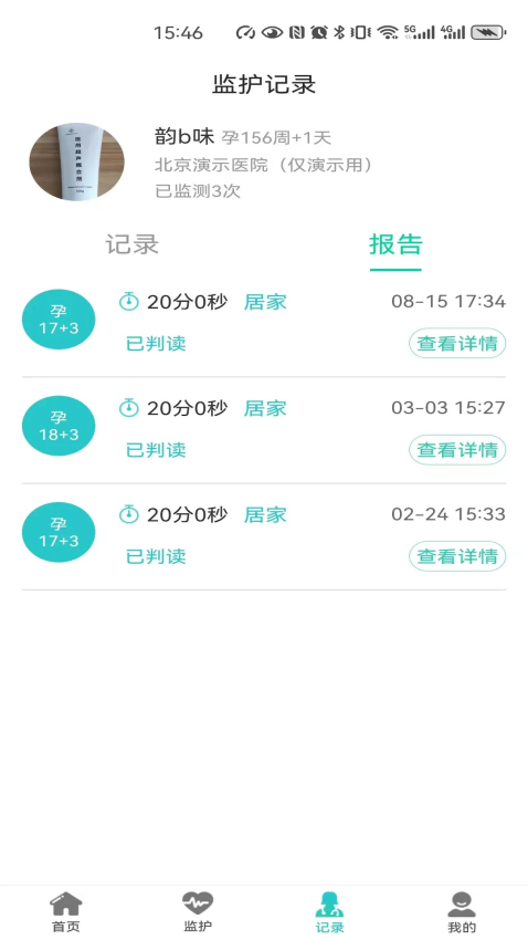 胎心监护官方版v1.0.24截图2